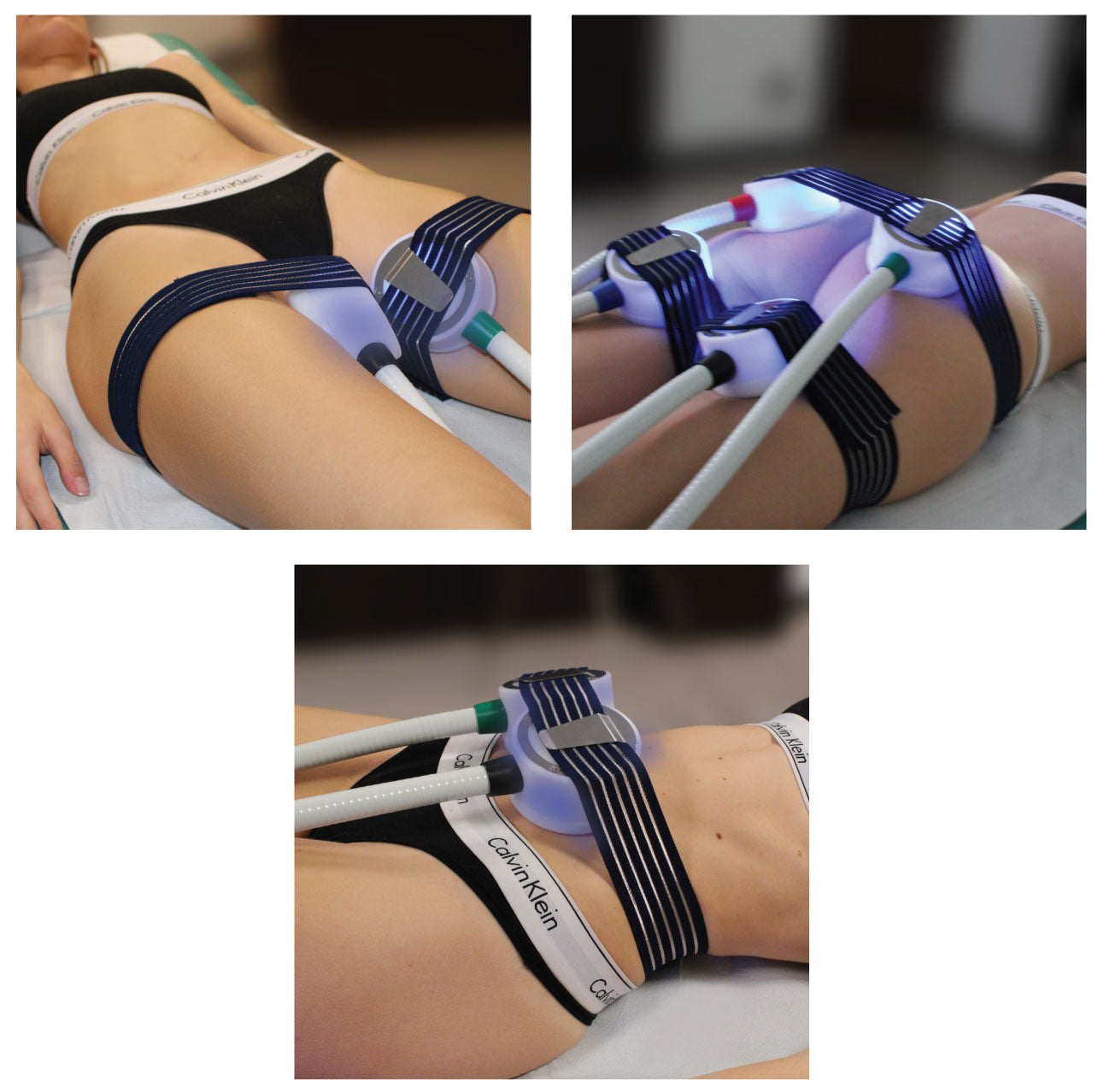 STAR CRYOTSHOCK 4.0 FİZYOTERAPİ & MEDİKAL ESTETİK