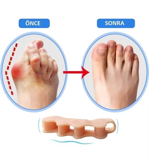 Silikon Parmak Ayırıcı Parmak Düzeltme Aparatı 1 ÇİFT