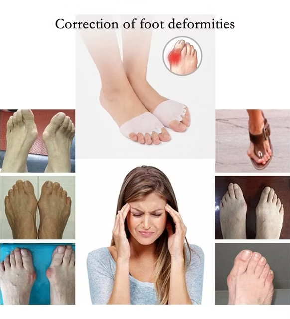 Jel ayak parmağı düzleştirici, ayak parmağı ayırıcısilikon Valgus düzeltici jel