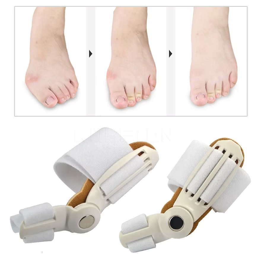 Hallux Valgus Aparatı
